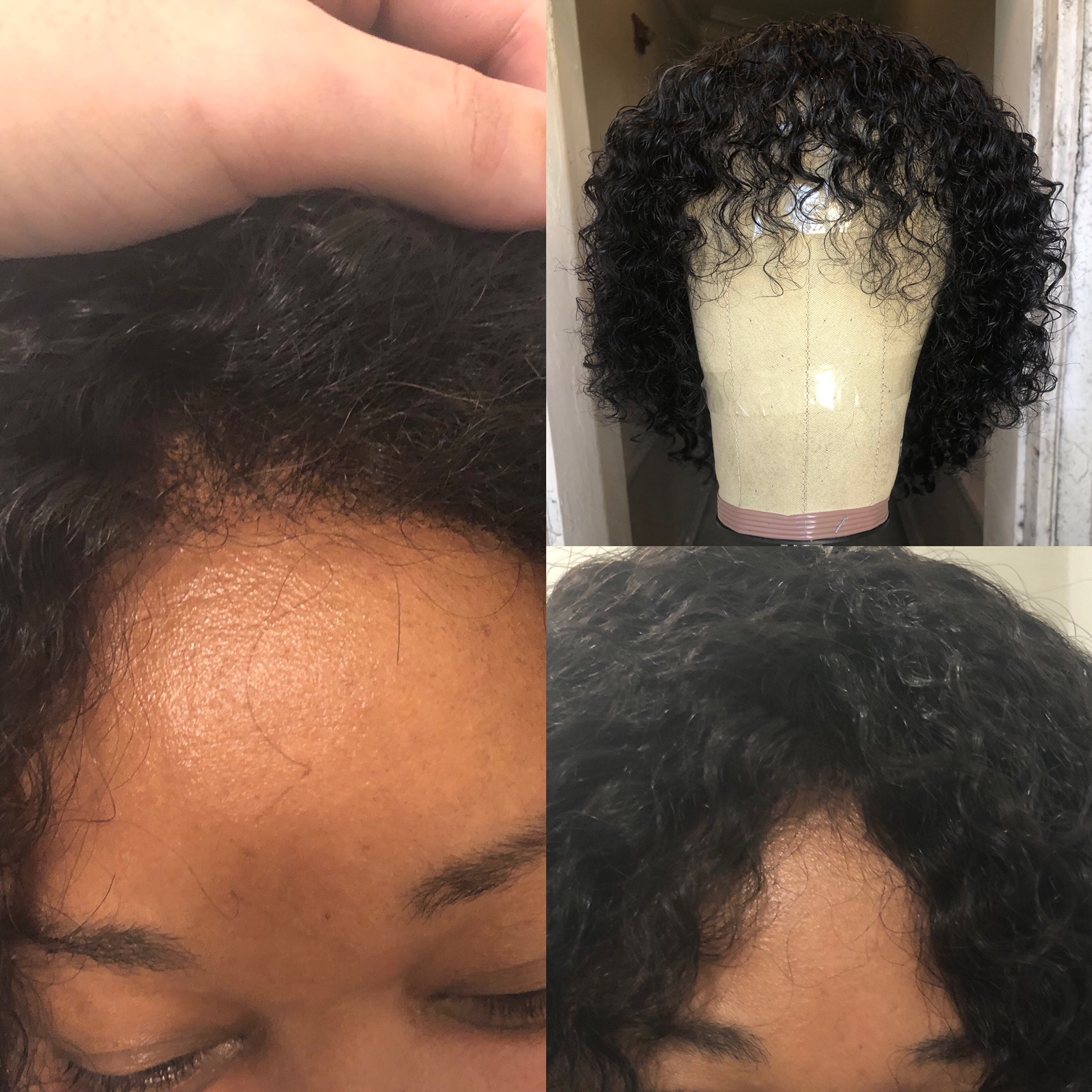 Custom Hairline / Refront